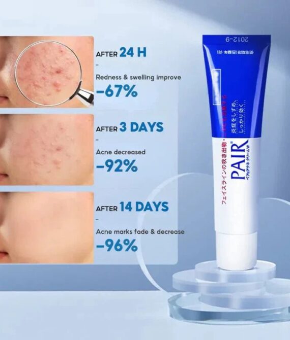 LION – Pair Acne Cream W – Crème anti-acné Pair W